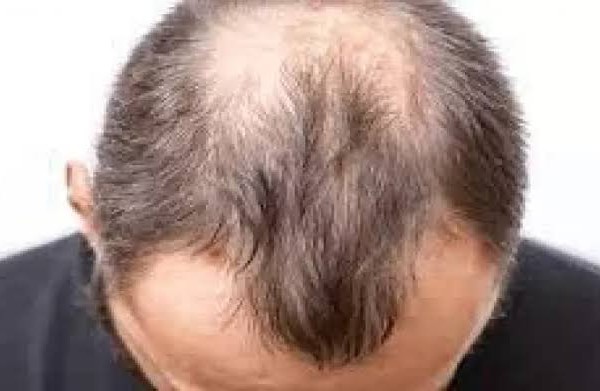 تسريح الشعر الخفيف