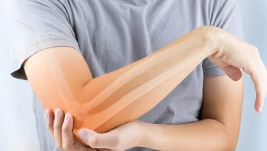 نقص كالسيوم الدم