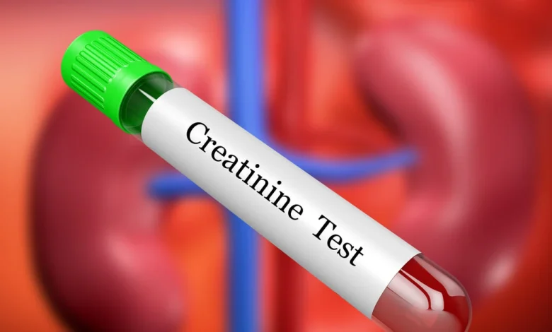 الكرياتينين