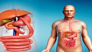 تحويل مسار المعدة