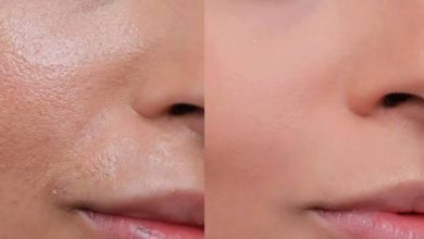 روتين البشرة الدهنية