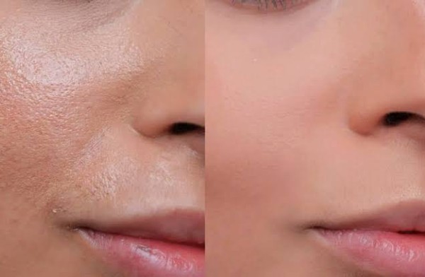 روتين البشرة الدهنية