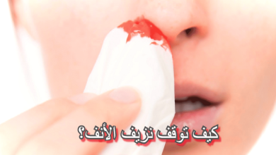 كيف اوقف نزيف الانف
