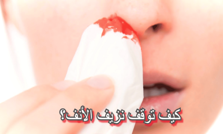 كيف اوقف نزيف الانف