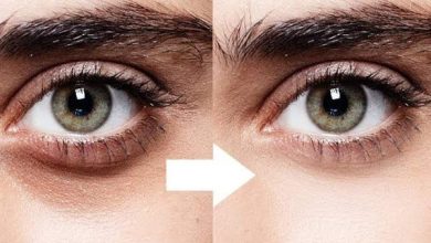 علاج الهالات السودة