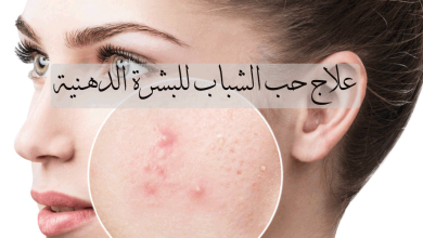 علاج حب الشباب للبشرة الدهنية