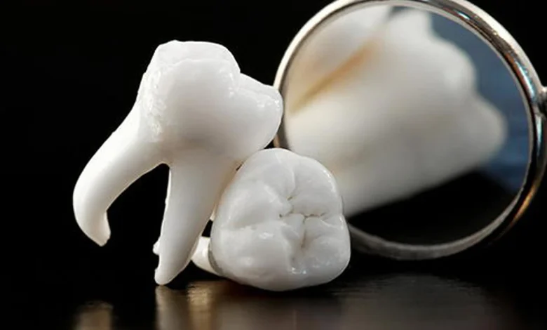 رؤية تساقط الأسنان في المنام