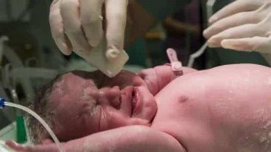 الفرق بين الولادة الطبيعية والقيصرية