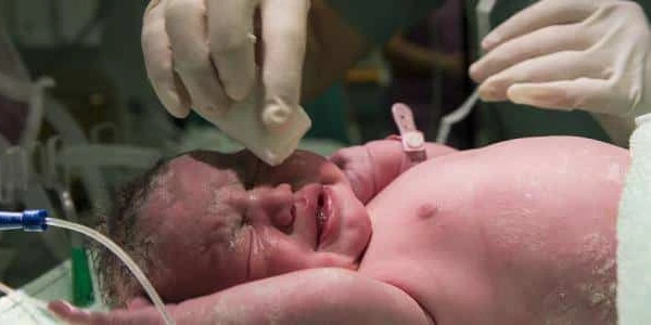 الفرق بين الولادة الطبيعية والقيصرية