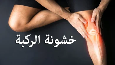 أسماء أدوية خشونة الركبة 