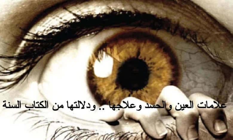 علامات العين والحسد وعلاجها .. ودلالتها من الكتاب السنة