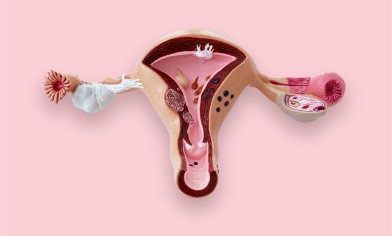 تفسير حلم نزول دم من المهبل