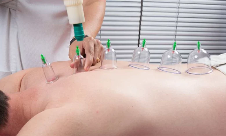 فوائد وأضرار الحجامة
