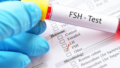 ما هو تحليل FSH
