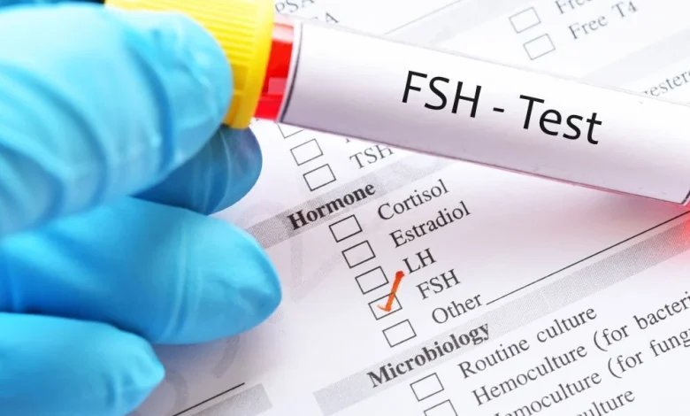 ما هو تحليل FSH
