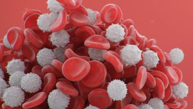 اللوكيميا مرض يصيب خلايا الدم الحمراء صح ام خطأ ؟