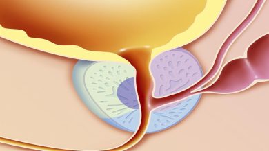 شفيت من التهاب البروستاتا المزمن