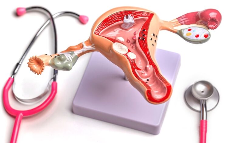 علاج حرقة في فتحة المهبل للعذراء