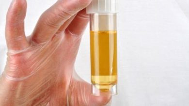 علاج نزول البروتين في البول