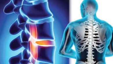 متى يسمح بالجماع بعد عملية الغضروف