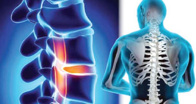 متى يسمح بالجماع بعد عملية الغضروف