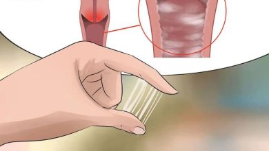 نزول خيوط بيضاء من المهبل قبل الدورة