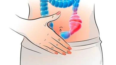 علاج الامساك