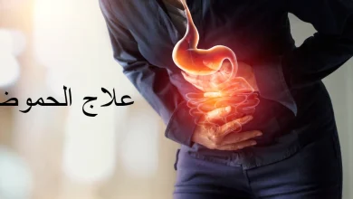  علاج الحموضة 