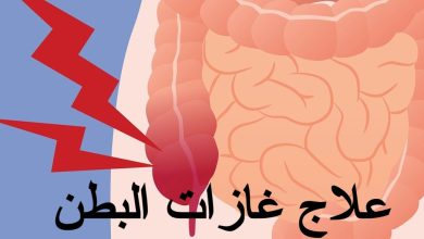 علاج غازات البطن