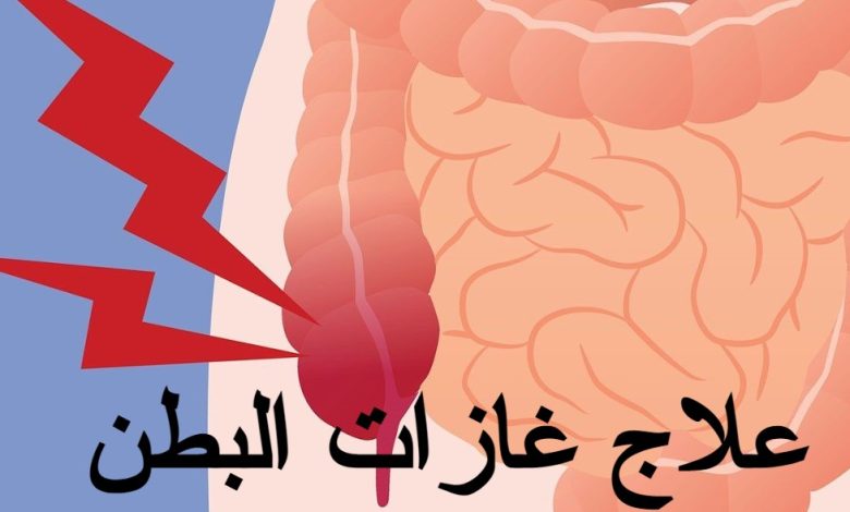 علاج غازات البطن
