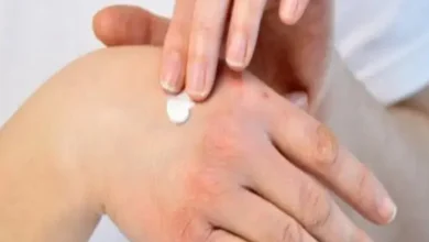 كريم مضاد حيوي