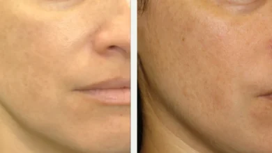 ماسك لتبييض الوجه