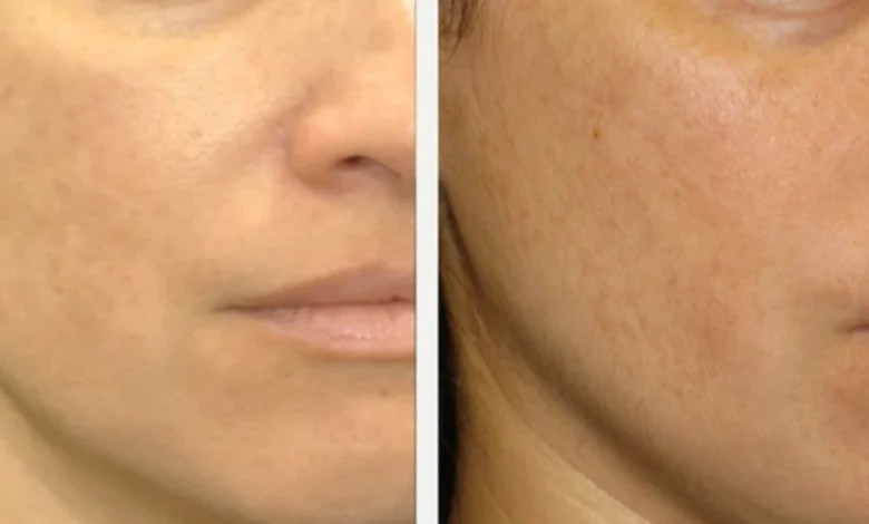 ماسك لتبييض الوجه