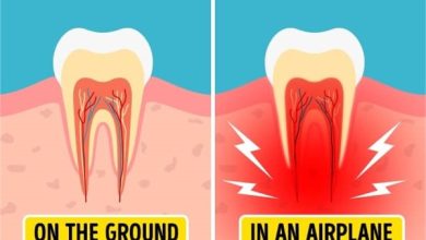 علاج ألم الأسنان الشديد