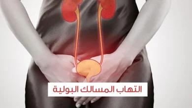 علاج التهاب المسالك البولية