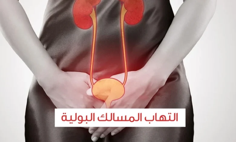 علاج التهاب المسالك البولية