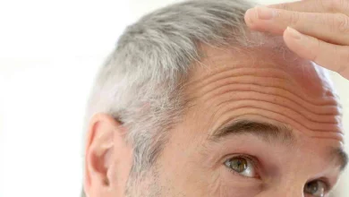 الشعر الابيض في المنام