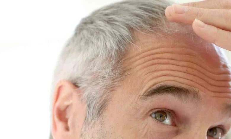 الشعر الابيض في المنام