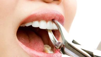 تفسير حلم خلع الطاحونة