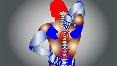 طريقة علاج الناسور العصعصي بدون جراحة