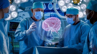 دكتور أعصاب عربي في ألمانيا