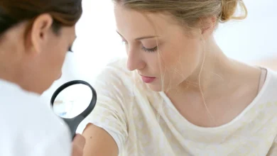 دكتور جلدية في دورتموند