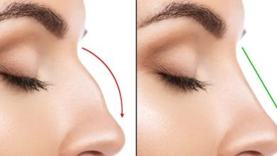 تجميل الأنف في ألمانيا