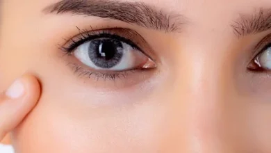 ماسك الهالات السوداء