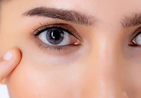 ماسك الهالات السوداء