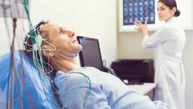 طبيب أعصاب عربي في شتوتغارت