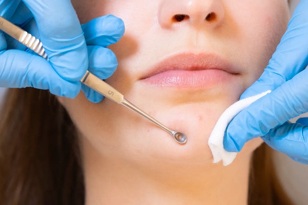 طبيب جلدية عربي في شتوتغارت