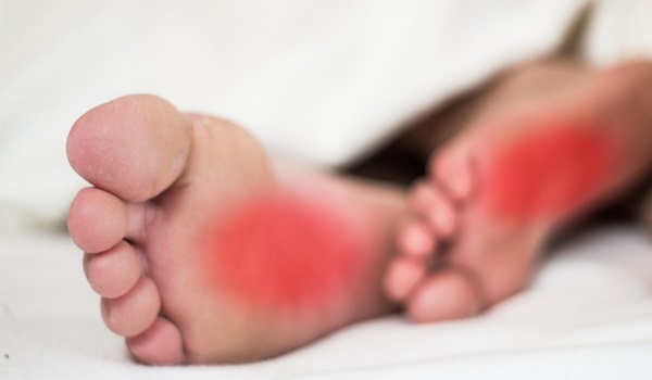 أسباب سخونة القدمين