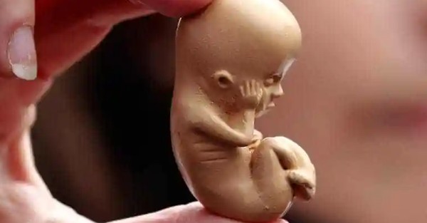 الاجهاض في المنام