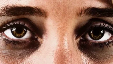 افضل كريم للهالات السوداء